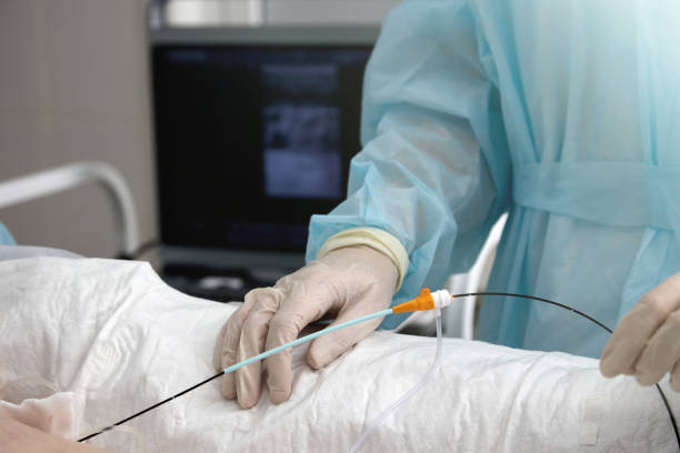 Venous Reflux